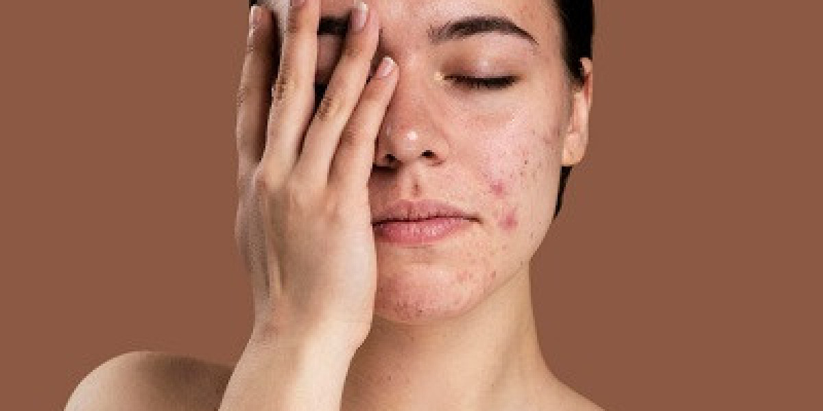 Discover Flawless Skin With Scar Removal Dubai Techniques