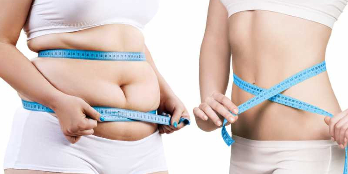 Begin Your Personal Transformation Experience at a Weight Loss Clinic in Dubai