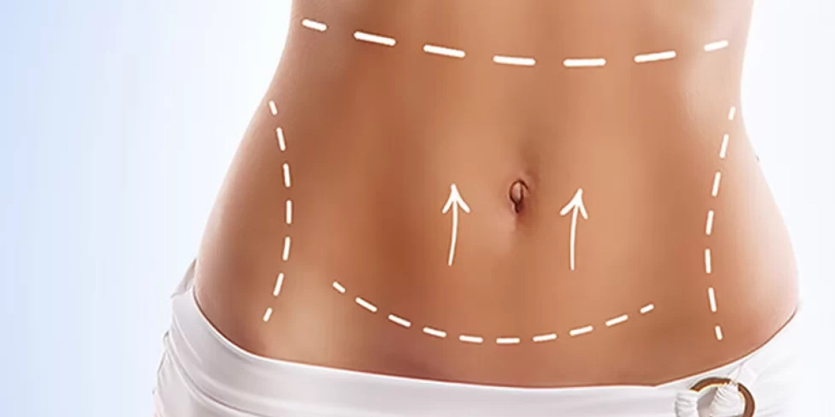 Smooth Contours, Renewed Confidence with a Tummy Tuck